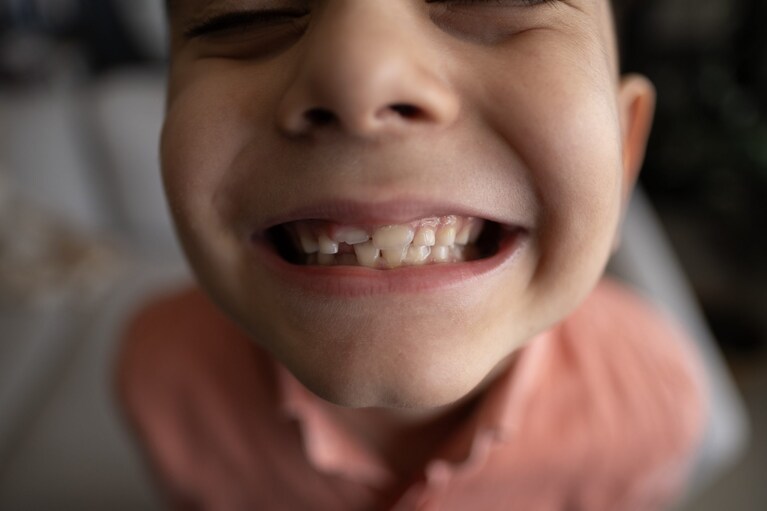 Salute dei denti fin da bambini