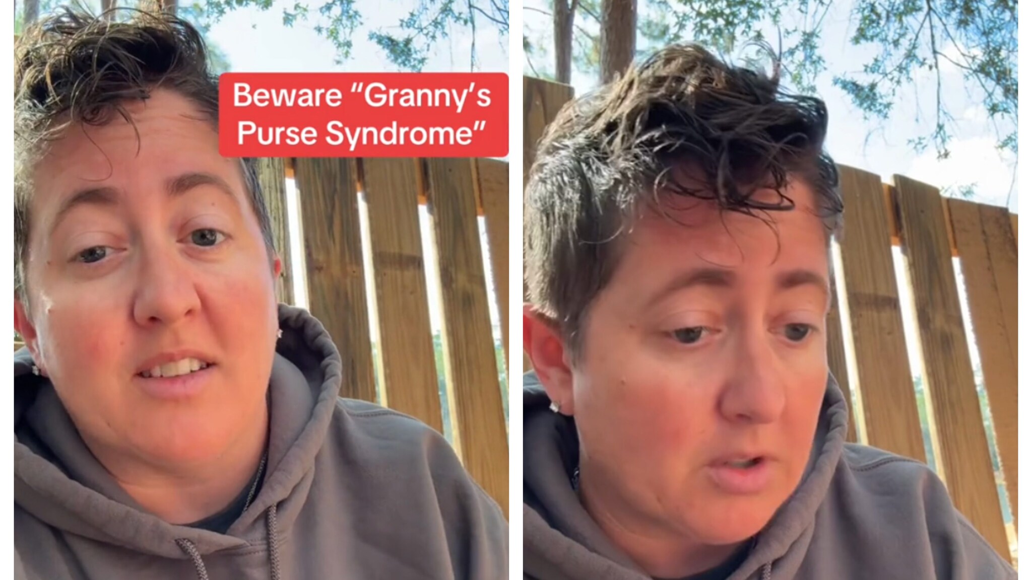 Sindrome della borsa della nonna