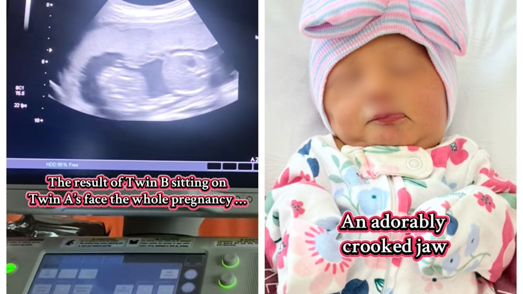 credits_ profilo TikTok @taylortwinmom