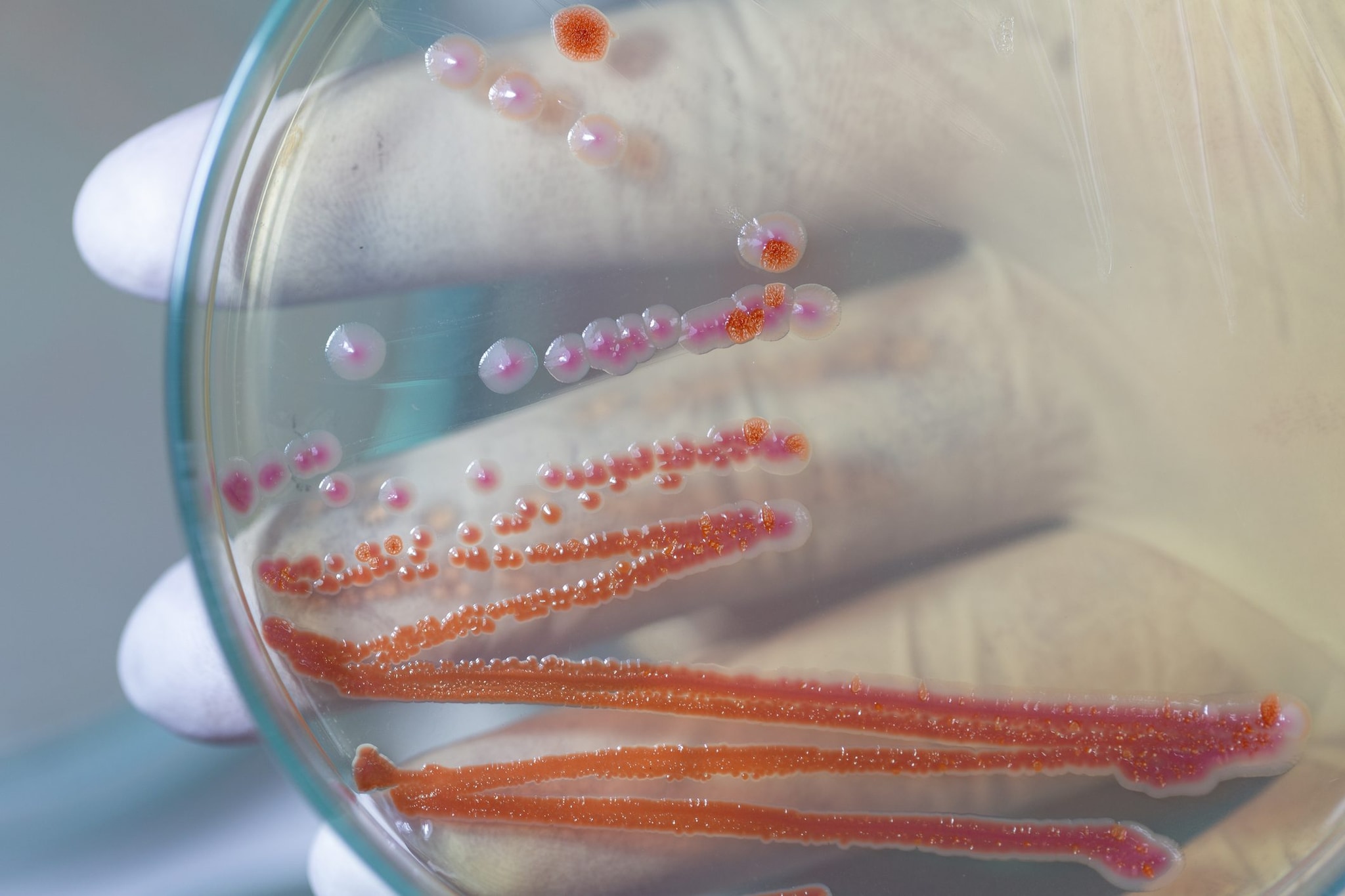 Un terreno di coltura con Serratia marcescens