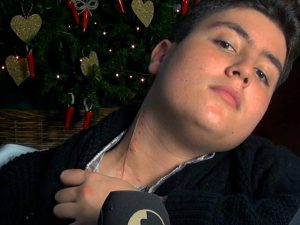 Arturo, il 17enne accoltellato a Via Foria, mostra la cicatrice sul collo.