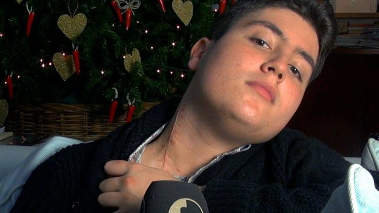 Perche Manuel Ha Una Cicatrice Sul Collo