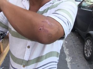 L’ambulante mostra le ferite dell’aggressione