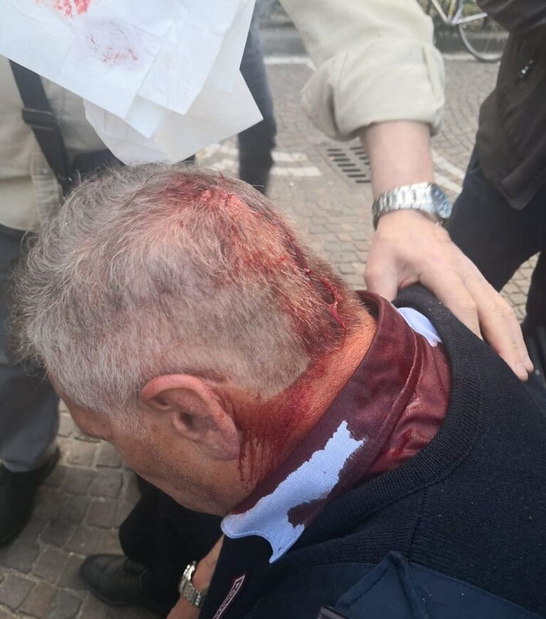 Il vigile urbano ferito dopo l'aggressione. [Foto di Michele Emiliano, sindaco di Crispano]