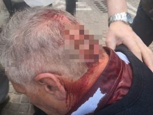 Il vigile urbano ferito dopo l'aggressione.