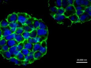 Cellule tumorali realizzate con la stampa 3D