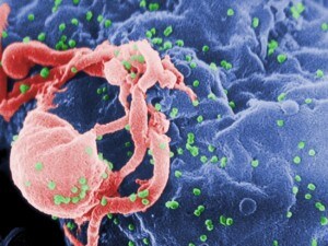 HIV–1 – Foto Wikipedia