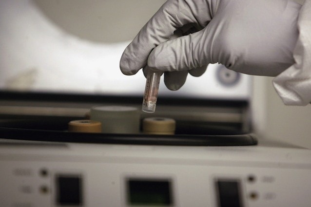 Stop Vivisection chiede l’abolizione della sperimentazione animale