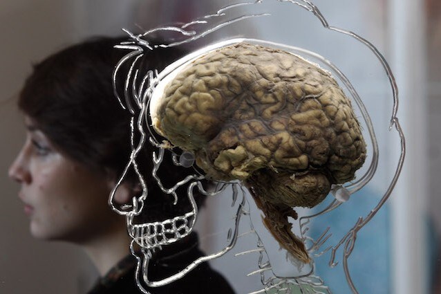 Creato il primo cervello in laboratorio