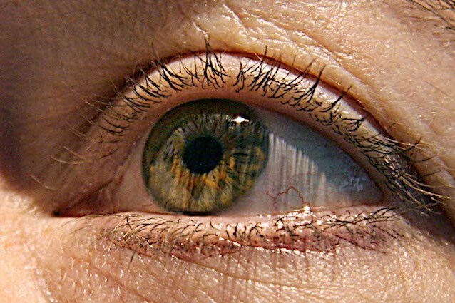 Un’alga per contrastare la cecità