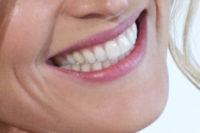 Il gene che amplifica le nostre emozioni