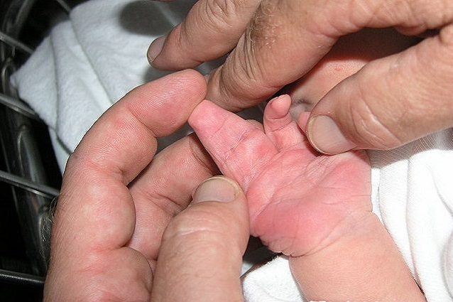 sindattilia