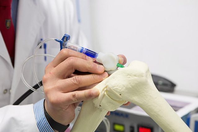 Osteoartrite addio: creata penna che stampa cellule staminali in 3D e ripara la cartilagine