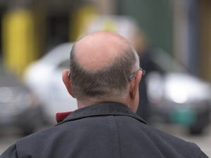 Cheratosi Pilare Cos E La Pelle Di Gallina Con Pallini Che Non Prudono E Come Si Cura