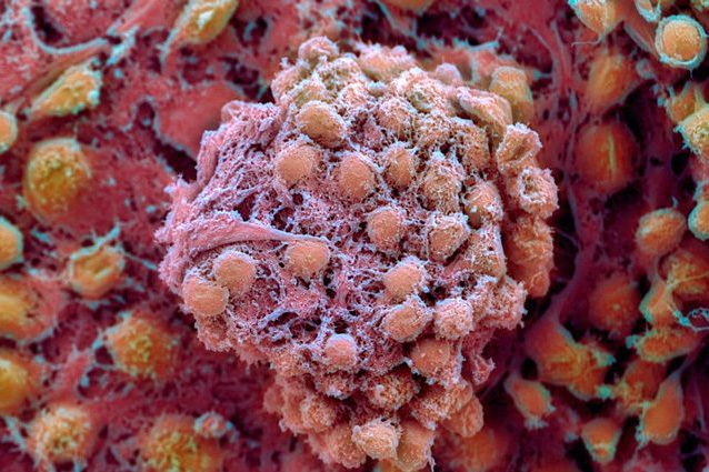 Credit: Prof. Miodrag Stojkovic / SPL / Nature
