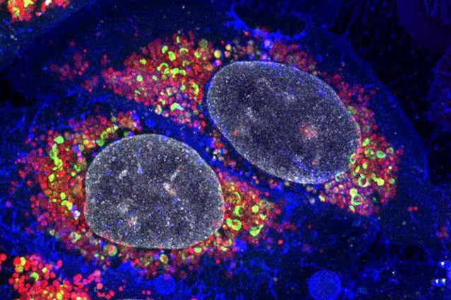 Credit: Padman/Monash Micro Imaging