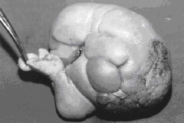 Credit: Nisreen M Khalifa et al – Khalifa NM, Maximous DW, Abd–Elsayed AA