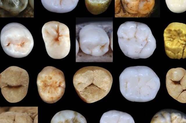 Quando l’uomo moderno si è separato dal Neanderthal? La risposta è nei denti