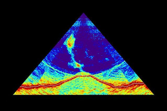 L’immagine ottenuta dal sonar del vulcano. Credit: MAYOBS – CNRS / IPGP / IFREMER / BRGM