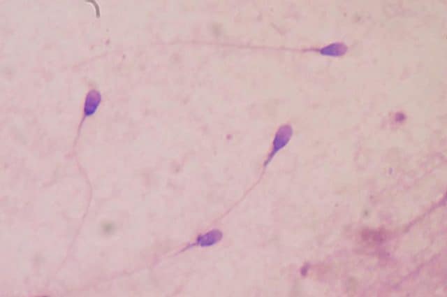 Spermatozoi