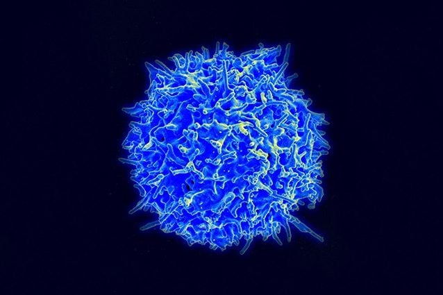 Una cellula T umana. Credit: NIAID/Flickr/CC BY 2.0