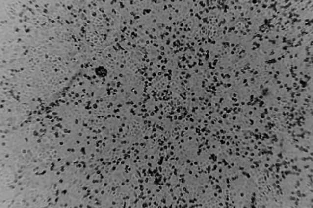 Coronavirus isolato in un laboratorio australiano. Credit: Doherty Institute