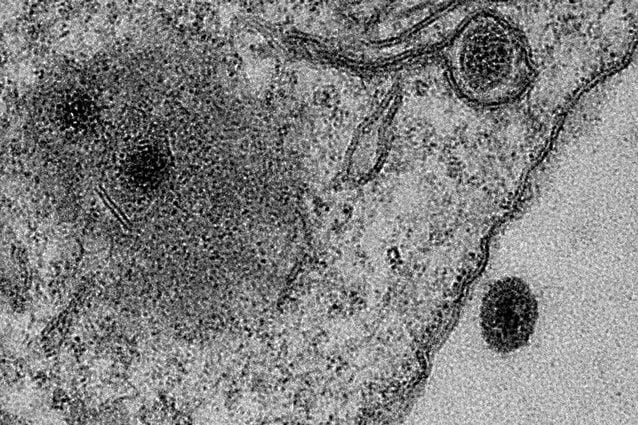 Lo Yaravirus visto al microscopio elettronico. Credit: J. ABRAHÃO AND B. LA SCOLA/IHU–MARSEILLE/MICROSCOPY CENTER UFMG–BELO HORIZONTE/Science Magazine