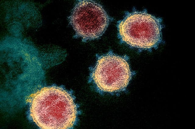 Il coronavirus visto al microscopio elettronico. Credit: NIAID