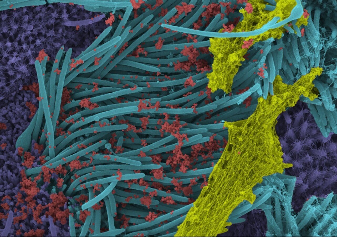 Virioni di coronavirus (in rosso)/ Ehre Lab, UNC School of Medicine