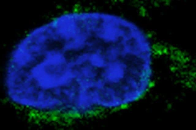 Una cellula Natural Killer. Credit: Ospedale Bambino Gesù
