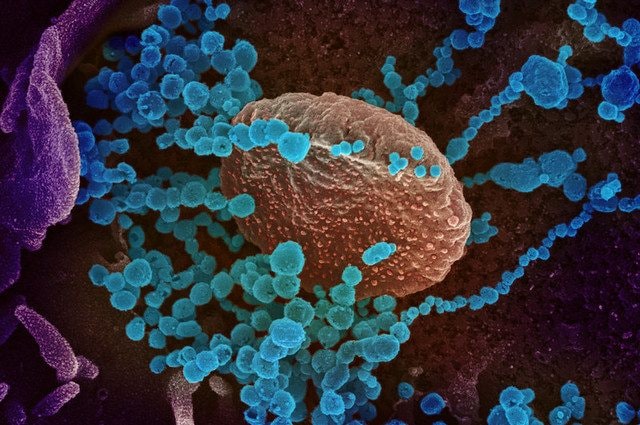 Particelle virali del coronavirus su cellule in coltura. Credit: NIAID