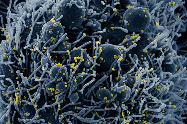 Particelle virali del coronavirus (in giallo). Credit: NIAID