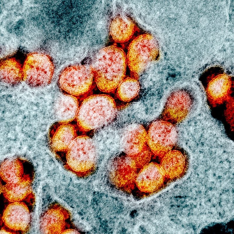 Particelle di coronavirus Sars–Cov–2 / NIAID
