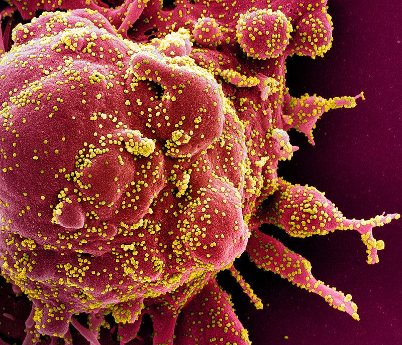 Particelle di coronavirus Sars–Cov–2 / NIAID