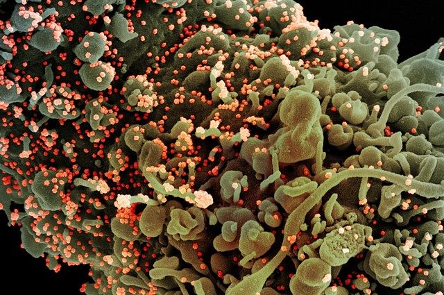 Particelle virali del coronavirus su cellule in coltura. Credit: NIAID