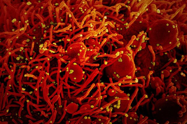 Coronavirus su cellule in coltura. Credit: NIAID