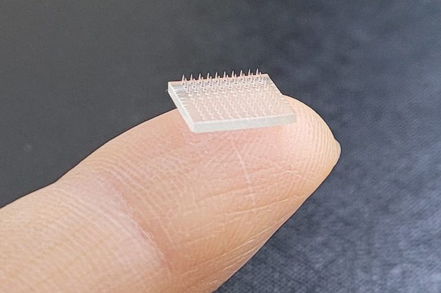 Il cerotto con i microaghi. Credit: Università della Carolina del Nord di Chapel Hill