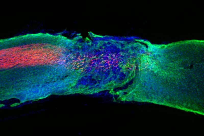 Una sezione del midollo spinale in un topo trattato con una singola iniezione del trattamento sperimentale. In rosso le fibre nervose rigenerate / Samuel Stupp