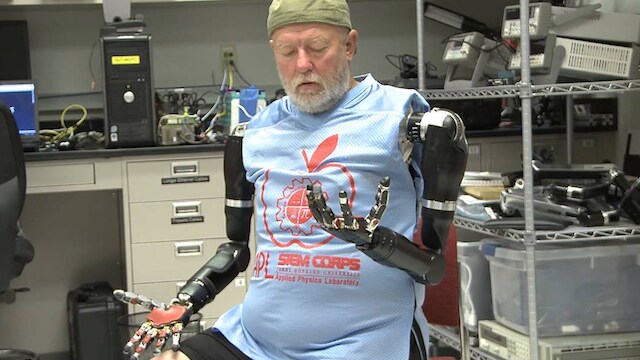 braccia robotica