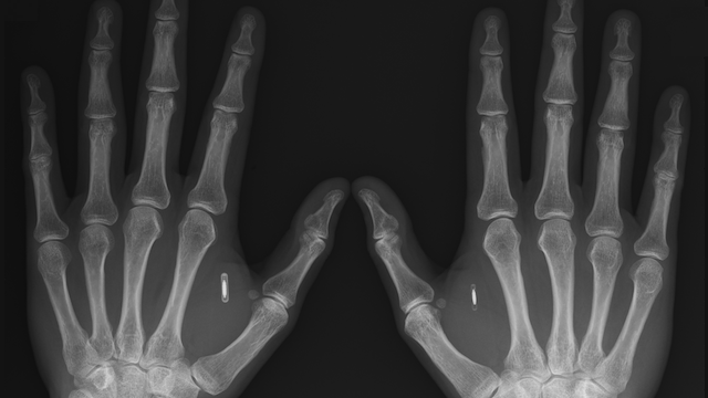 biohacking stoccolma azienda