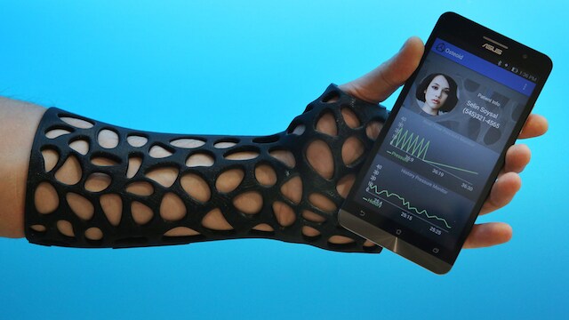 Smart Splint