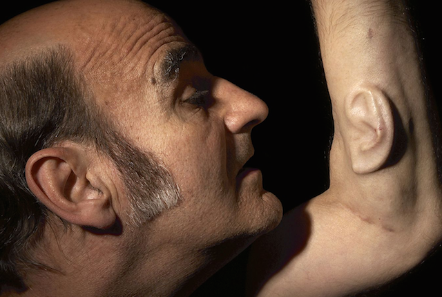 stelarc orecchio