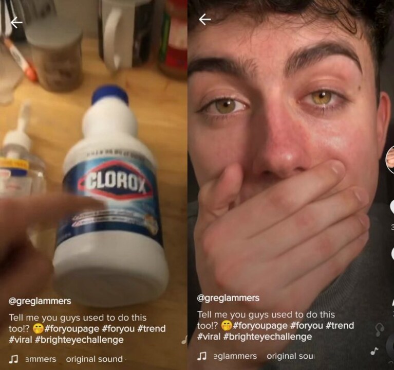 bright eye challenge tiktok