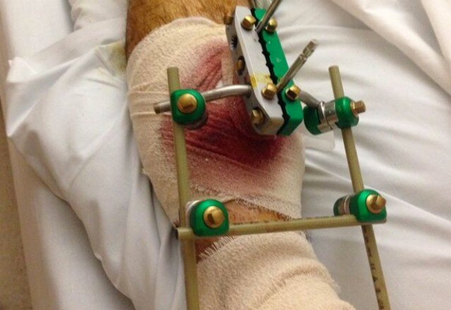 L’immagine della gamba lesionata tratta dal Manchester Evening News